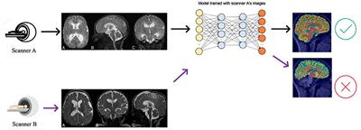 A domain adaptation benchmark for T1-weighted brain magnetic resonance image segmentation